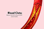 How To Get Rid Of Blood Clots : 4 Natural Remedies And Treatments | How To Cure