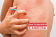 How To Get Rid Of Candida - 5 Amazing Natural Ways | How To Cure