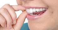 Flemington Dental Care: Teeth Straightening Treatment, This is How You Go for it