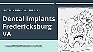 All About Dental Implants Fredericksburg VA - Spotsylvania Oral Surgery by Spotsylvania Oral Surgery - Issuu