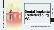 All About Dental Implants Fredericksburg VA - Spotsylvania Oral Surgery by Spotsylvania Oral Surgery - Issuu