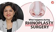 Know what happens during Rhinoplasty Surgery (Nose Job) | Nose Surgery in India (हिंदी में)