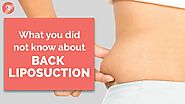 Facts about Back Liposuction by Dr. Shilpi Bhadani | Best Plastic Surgeon in India