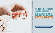 9 Reasons You Need Dental Implants | Lambton Family Dental