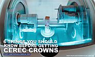 6 Things You Should Know Before Getting CEREC Crowns | Lambton Family Dental