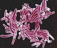 Bioseguridad en tuberculosis