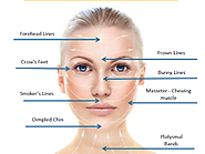 Anti-Wrinkle Injection is available at Box Hill Superclinic