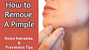 How to Remove a Pimple | 6 Effective Ways to Get Rid of Pimples