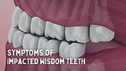 Symptoms of Impacted Wisdom Teeth