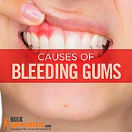 Bleeding Gums: Characteristics, Causes & Treatment | BulkSupplements.com