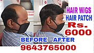 Hair Wigs Store in Delhi | 9643765000 | Hair Wigs for Men