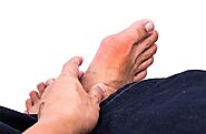 Acute gout attack