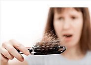 Natural Treatment For Hair Loss and Baldness