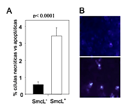Caracterización genética y papel en la patogénesis de SmcL, una esfingomielinasa C de "Listeria ivanovii" - E-Prints ...
