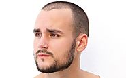 How to Effectively Fix a Patchy Beard (Bald Spot) - Beardoholic