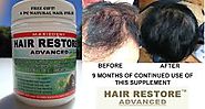 UPDATE 1 Year and 8 months Using iRestore Laser Hair Helmet