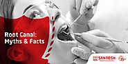 Root Canal Myths & Facts