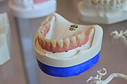 Does Teeth Whitening Hurt? – Admire Dentistry