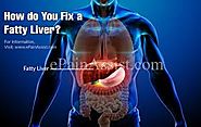 Fatty Liver Disease: Nonalcoholic & Alcoholic Steatohepatitis (NAFLD/AFLD)