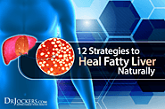 12 Strategies to Heal Fatty Liver Naturally - DrJockers.com