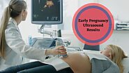 Early Pregnancy Ultrasound Results