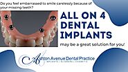 Looking for All on 4 Dental Implants Treatment in Perth?