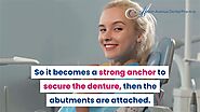 Significance of All-on-4 Dental Implants | Ashton Avenue Dental Practice