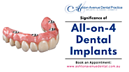 What is the Importance of All-on-4 Dental Implants?