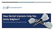 Some Guidelines About Dental Implants