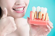 What is the Process of All-on-4 Dental Implants?