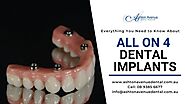 All on 4 Dental Implants Cost in Perth – All About All on 4 or 6 Implants | Claremont Dental Blog