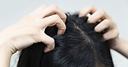 Effective Itchy Scalp Treatment - Find Out What Works Best For You