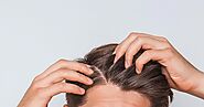 How to treat hair and scalp conditions? - My Blog