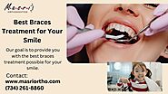 Best Braces Treatment for Your Smile