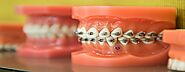Best Dental Implants Clinic in Dubai - Tooth Implants | Euromed® Clinic