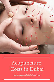 How Much Acupuncture Costs in Dubai? | Euromed® Clinic