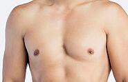 Get Rid of Gynecomastia – Male Breast Reduction | Articles Maker