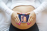What are the advantages of a 4D well-being scan during pregnancy?