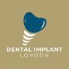 Dental Implants London