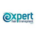 ExpertHair Transplant